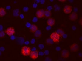 IL-1 beta /IL-1F2 antibody in Human PBMCs by Immunocytochemistry (ICC).