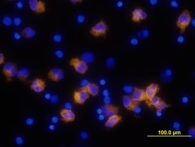 IL-1 beta /IL-1F2 antibody in Human PBMCs by Immunocytochemistry (ICC).