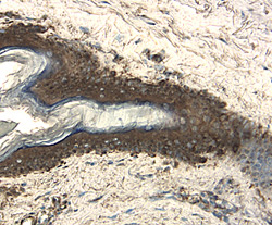 IL-20 Ra antibody in Human Skin by Immunohistochemistry (IHC-P).