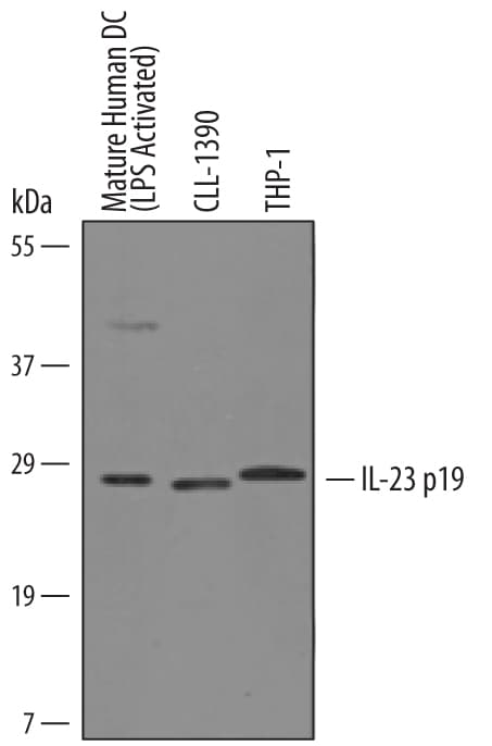 Detection of Human and Canine IL-23 p19 antibody by Western Blot.