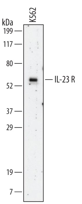 Detection of Human IL-23 R antibody by Western Blot.
