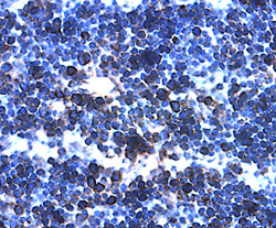 IL-27 p28/IL-30 antibody in Mouse Thymus by Immunohistochemistry (IHC-P).