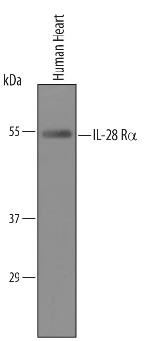 Detection of Human IL-28 Ra/IFN-? R1 antibody by Western Blot.