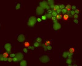IL‑2 antibody in Human PBMCs by Immunocytochemistry (ICC).