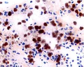 IL‑2 R beta  antibody in Human Lymph Node by Immunohistochemistry (IHC-Fr).