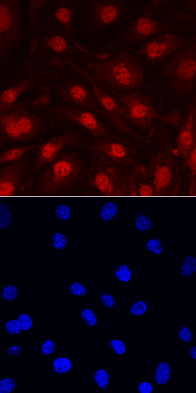 IL-33 antibody in bEnd by Immunocytochemistry (ICC).3 Mouse Cell Line by Immunocytochemistry (ICC).