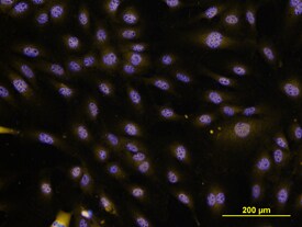 IL-33 antibody in HUVEC Human Cells by Immunocytochemistry (ICC).