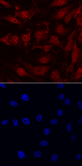 IL‑33 antibody in bEnd by Immunocytochemistry (ICC).3 Mouse Cell Line by Immunocytochemistry (ICC).
