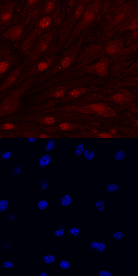IL‑33 antibody in bEnd by Immunocytochemistry (ICC).3 Mouse Cell Line by Immunocytochemistry (ICC).