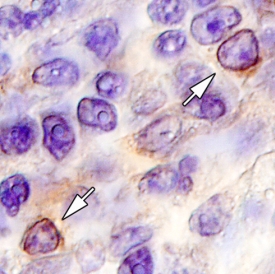 IL-3 Ra/CD123 antibody in Human Tonsil by Immunohistochemistry (IHC-P).