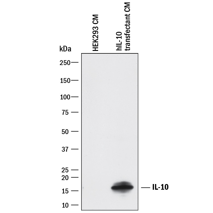 Detection of Human IL-10 antibody by Western Blot.