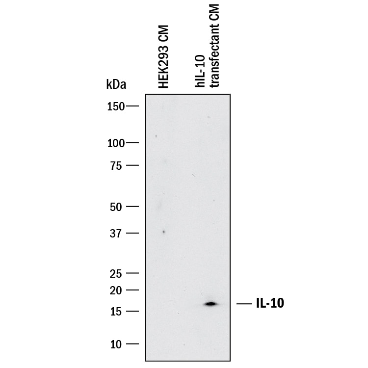 Detection of Human IL-10 antibody by Western Blot.