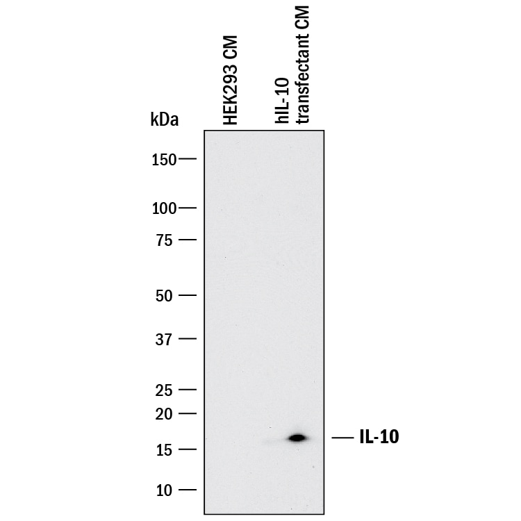 Detection of Human IL-10 antibody by Western Blot.