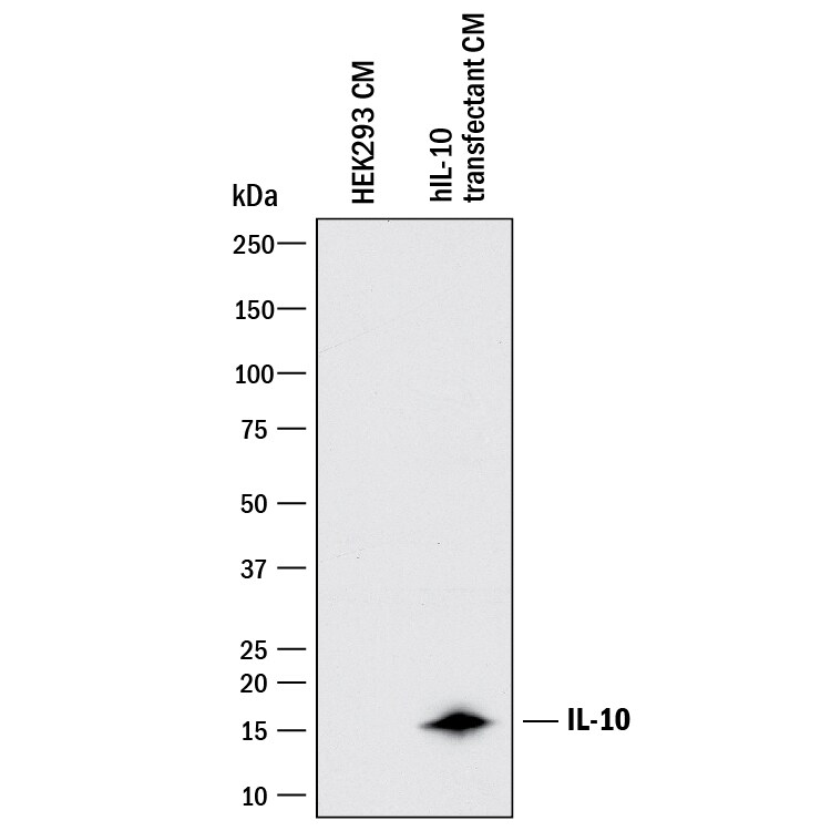 Detection of Human IL-10 antibody by Western Blot.