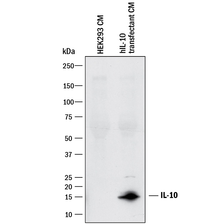 Detection of Human IL-10 antibody by Western Blot.