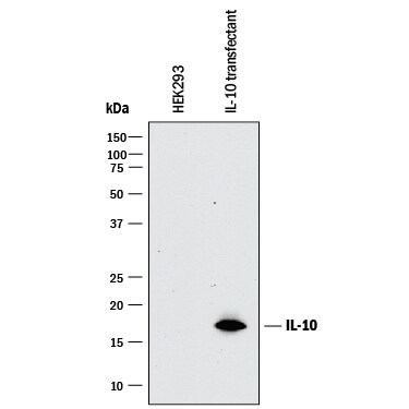 Detection of IL-10 antibody by Western Blot.