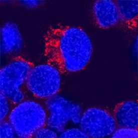 IL-12 antibody in Human PBMCs by Immunocytochemistry (ICC).