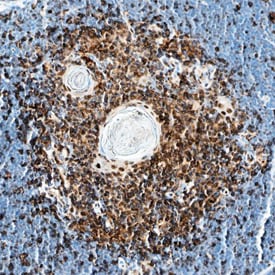 IL-13 Ra2 antibody in Mouse Thymus by Immunohistochemistry (IHC-Fr).