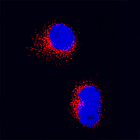 IL-17F antibody in Human Th17 Cells by Immunocytochemistry (ICC).