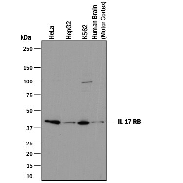 Detection of Human IL-17 RB antibody by Western Blot.