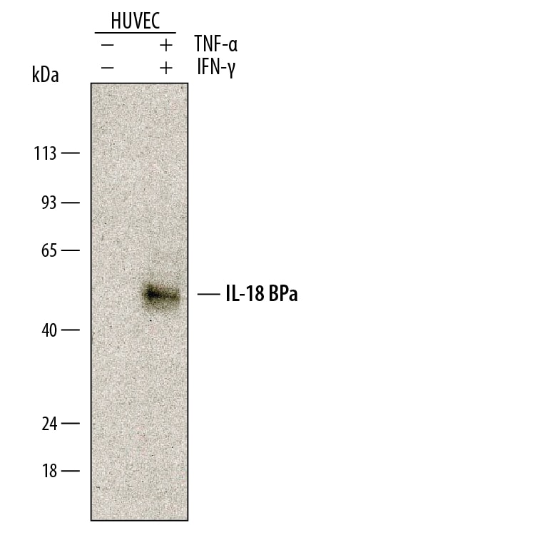 Detection of Human IL-18 BPa antibody by Western Blot.