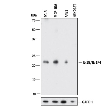 Detection of Human IL-18/IL-1F4 antibody by Western Blot.