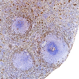 IL-18/IL-1F4 antibody in Human Spleen by Immunohistochemistry (IHC-P).