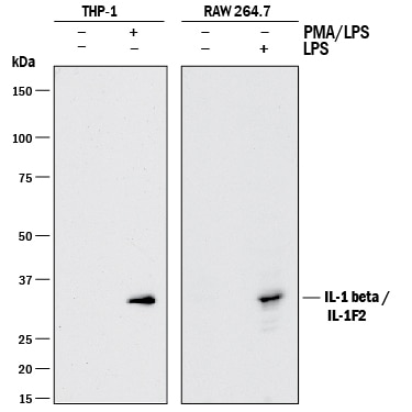 Detection of Human and Mouse IL-1 beta /IL-1F2 antibody by Western Blot.