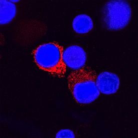 IL-1 beta /IL-1F2 antibody in Human Peripheral Blood Mononuclear Cells by Immunocytochemistry (ICC).