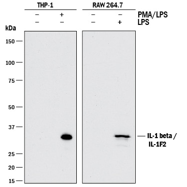 Detection of Human and Mouse IL-1 beta /IL-1F2 antibody by Western Blot.