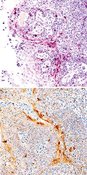 IL-1 beta /IL-1F2 antibody in Human Tonsil Using Dual RNAscope®ISH and IHC.