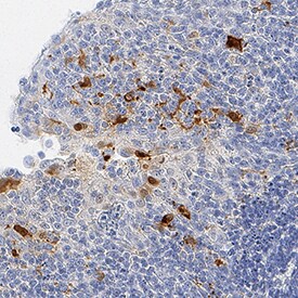 IL-1 beta /IL-1F2 antibody in Human Tonsil by Immunohistochemistry (IHC-P).