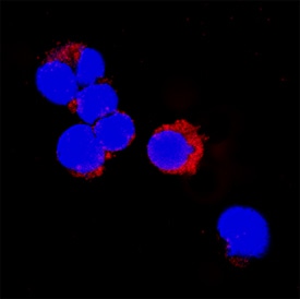 IL-1 beta /IL-1F2 antibody in MCF-7 Human Cell Line by Immunocytochemistry (ICC).