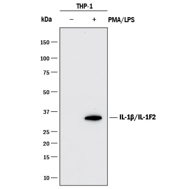 Detection of Human IL-1 beta /IL-1F2 antibody by Western Blot.