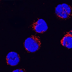 IL-1 beta /IL-1F2 antibody in Human PBMCs by Immunocytochemistry (ICC).