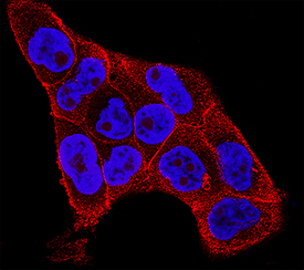 IL-1ra/IL-1F3 antibody in A431 Human Cell Line by Immunocytochemistry (ICC).