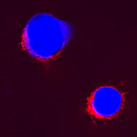 IL-2 antibody in Bovine PBMCs by Immunocytochemistry (ICC).