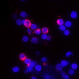 IL-2 antibody in Human PBMCs by Immunocytochemistry (ICC).