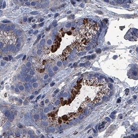 IL-2 antibody in Human Stomach by Immunohistochemistry (IHC-P).