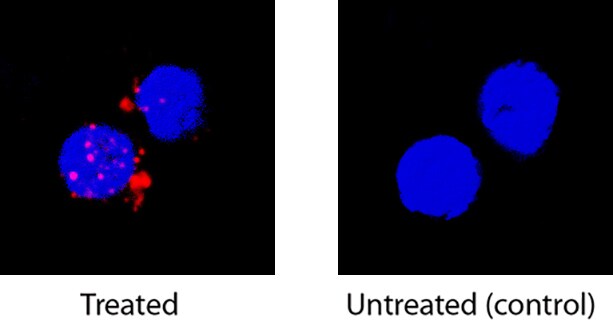 IL-2 antibody in Human PBMCs by Immunocytochemistry (ICC).
