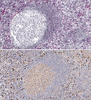 IL-33 antibody in Human Tonsil Using Dual RNAscope®ISH and IHC.
