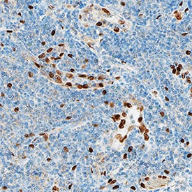 IL-33 antibody in Human Tonsil by Immunohistochemistry (IHC-P).