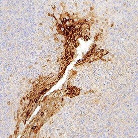 IL-36a/IL-1F6 antibody in Human Tonsil by Immunohistochemistry (IHC-P).