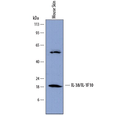 Detection of Mouse IL-38/IL-1F10 antibody by Western Blot.