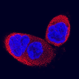 IMPA1/IMP1 antibody in HCT-116 Human Cell Line by Immunocytochemistry (ICC).