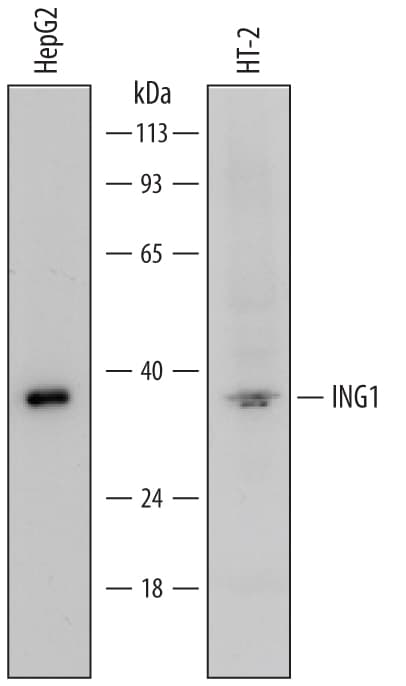 Detection of Human and Mouse ING1 antibody by Western Blot.