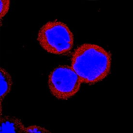 IRF5 antibody in THP-1 Human Cell Line by Immunocytochemistry (ICC).