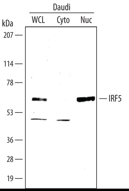 Detection of Human IRF5 antibody by Western Blot.
