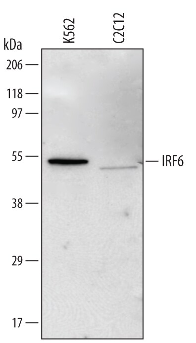 Detection of Human and Mouse IRF6 antibody by Western Blot.