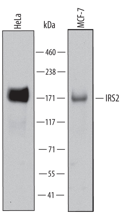Detection of Human IRS2 antibody by Western Blot.
